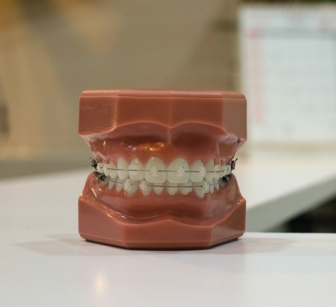 Ortodontske bravice