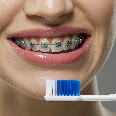 Oralna higijena tokom nošenja fiksne proteze za zube