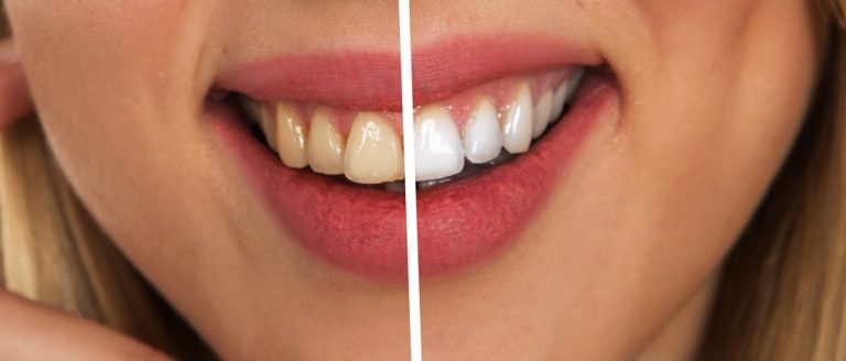 Estetska stomatologija - umetnički pristup osmehu