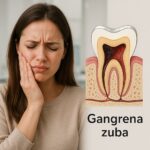 Gangrena zuba i lečenje