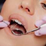 kiretaža paradontalnih džepova