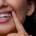 Recesija desni Kada počinje oštećenje korena zuba