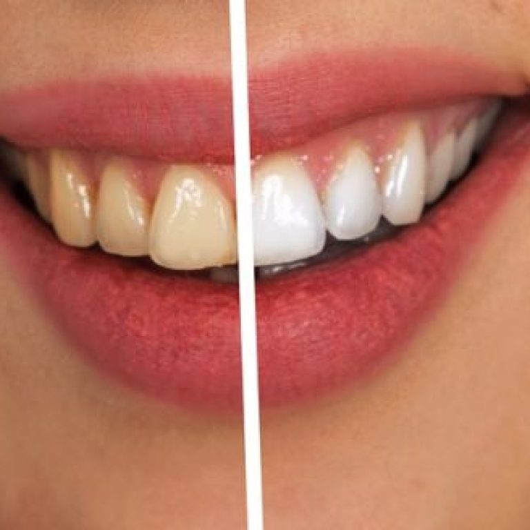 Estetska stomatologija - umetnički pristup osmehu